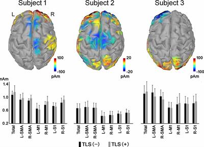 Electroencephalographic Functional Connectivity With the Tacit Learning System Prosthetic Hand: A Case Series Using Motor Imagery